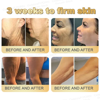 👩‍🔬✨Celsiora® PDRN Multi-Peptide Firming Serum Stick👩‍🔬LAST DAY 70% OFF