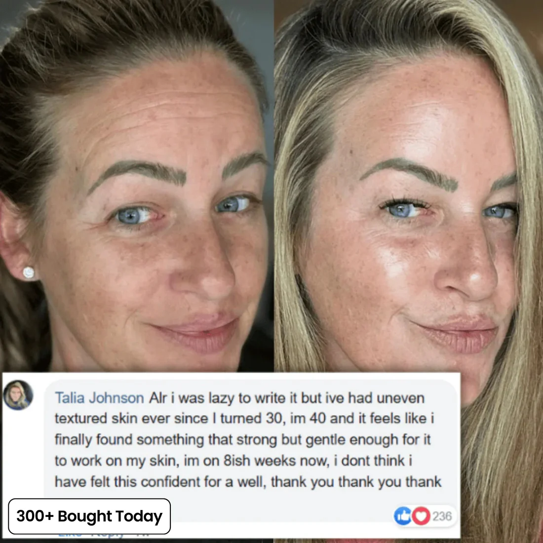 ✨LAST DAY BUY 1 GET 1 FREE✨Revive Tired Eyes – Hydrating & Anti-Wrinkle Eye Balm