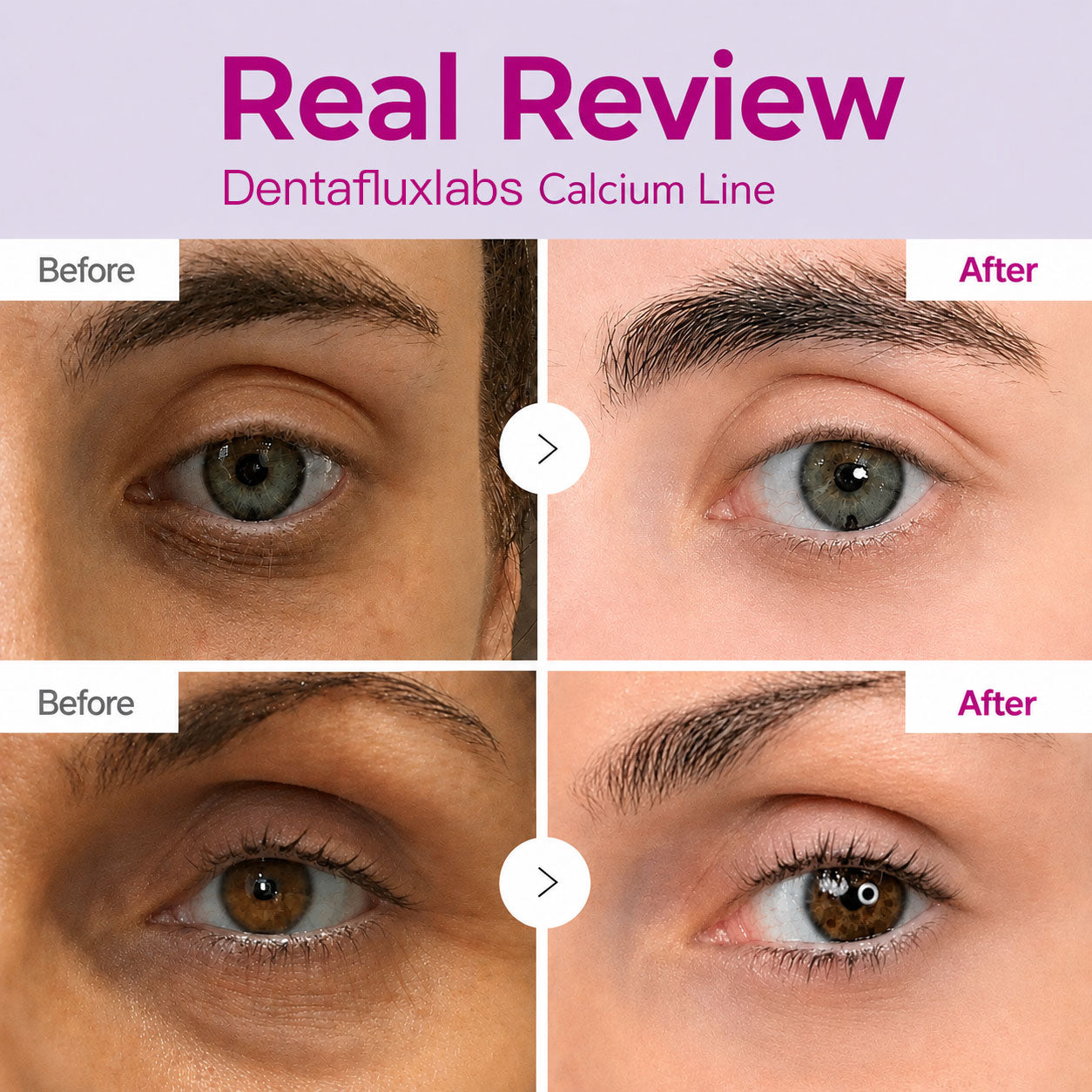 🔥 LAST DAY 50% OFF! Korean Dentafluxlabs Eye Cream for Dark Circles & Tired Eyes