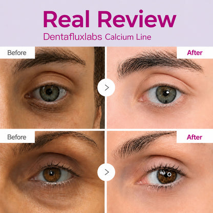 🔥 LAST DAY 50% OFF! Korean Dentafluxlabs Eye Cream for Dark Circles & Tired Eyes
