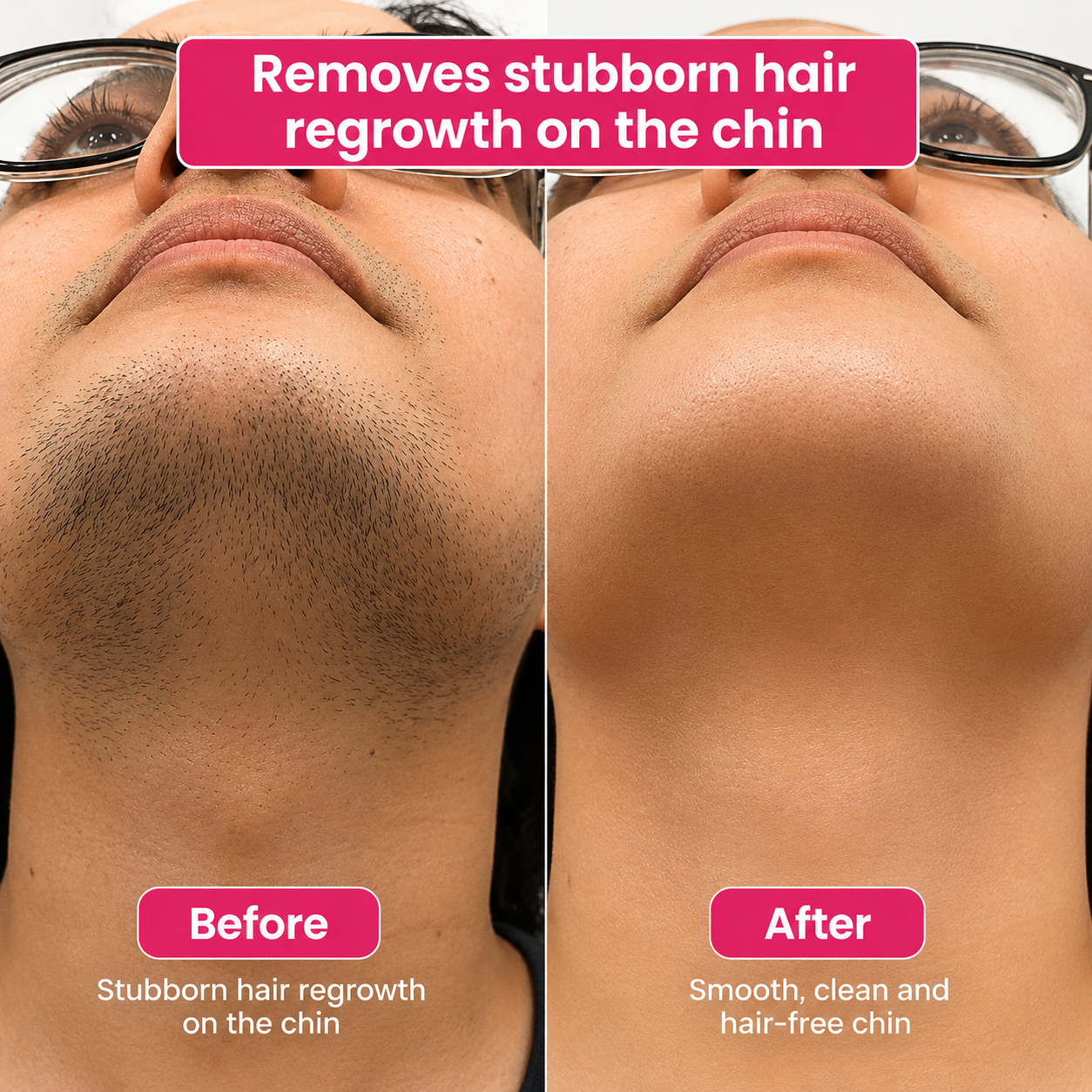 🔥LAST DAY 60% OFF  Dentafluxlabs Hair Reduction Oil 60 ml – Permanent Hair Removal Oil