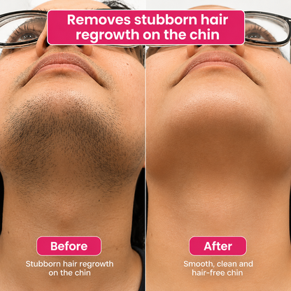 🔥LAST DAY 60% OFF  Dentafluxlabs Hair Reduction Oil 60 ml – Permanent Hair Removal Oil