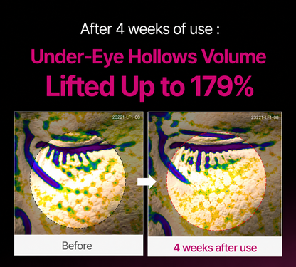 🔥 LAST DAY 50% OFF! Korean Dentafluxlabs Eye Cream for Dark Circles & Tired Eyes